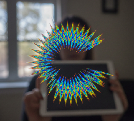 Neuro-Ophthalmology_CommonCauses_Migraine-related-visual-disturbances