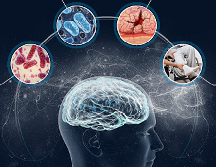 Disease-specific neurological treatment (e.g., stroke or multiple sclerosis management)